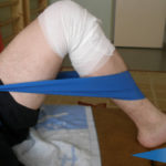 Упражнения после эндопротезирования суставов ног